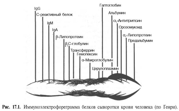 Иммуноэлектрофореграмма белков сыворотки крови человека (по Генри)